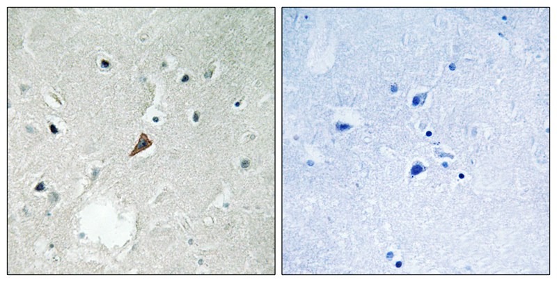 Anti-Phospho-PYK2 (Tyr579) Polyclonal Antibody