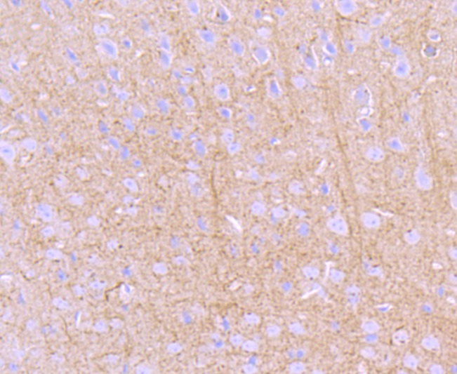 Anti-PKA 2 beta Antibody (8T490)