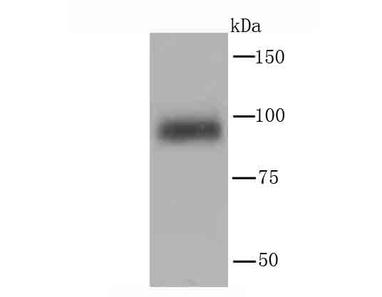 Anti-PI 3 Kinase p110 delta Antibody (6K824)