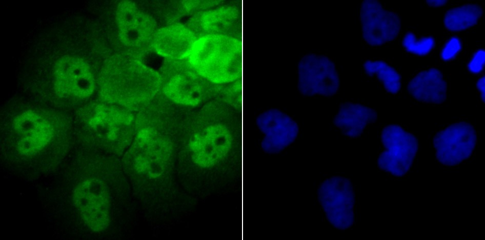 Anti-PSMB8 Antibody (3I410)