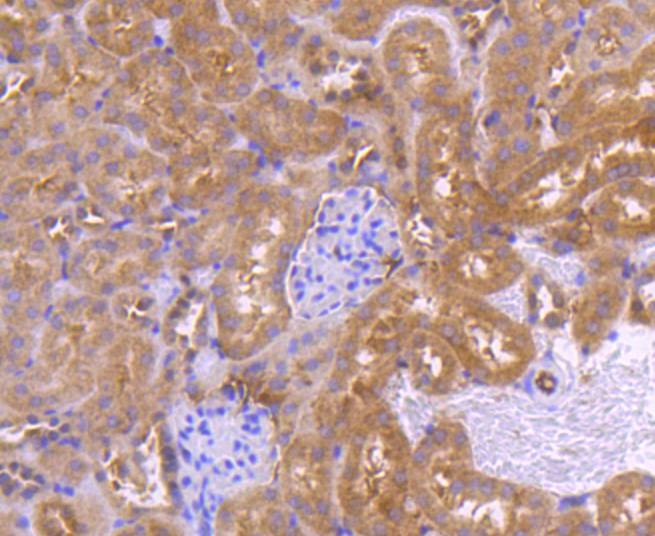 Anti-PRMT5 Antibody (3P436)