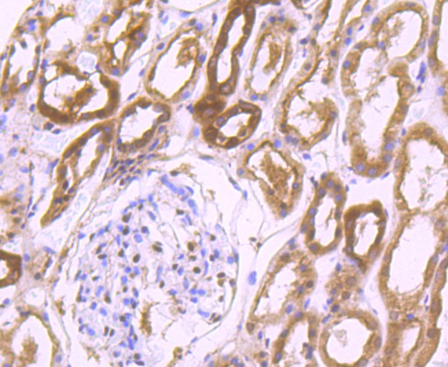Anti-PSMB8 Antibody (3I410)