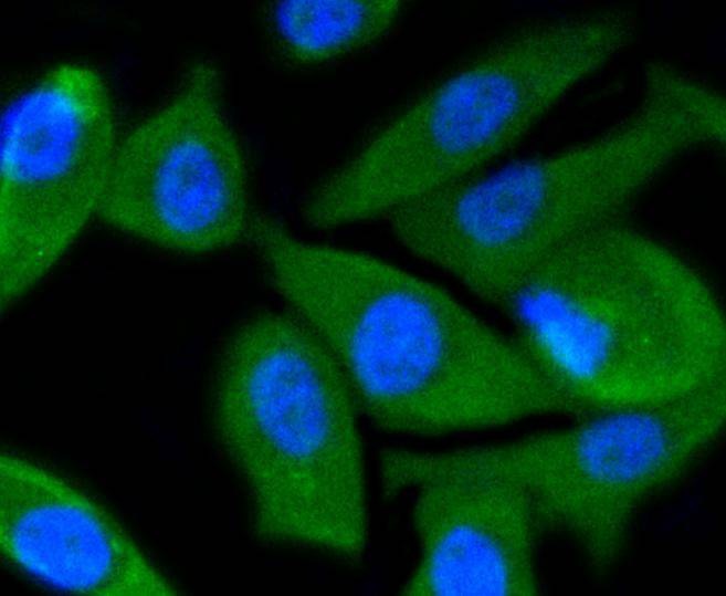Anti-PI 3 Kinase p55 gamma Antibody (1C282)