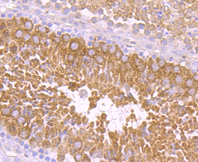 Anti-PIWIL1 Antibody (9H748)