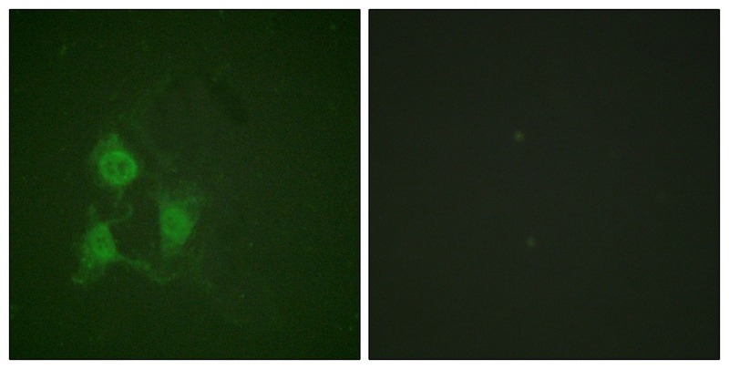 Anti-Phospho-PRKCA (Thr197) Polyclonal Antibody