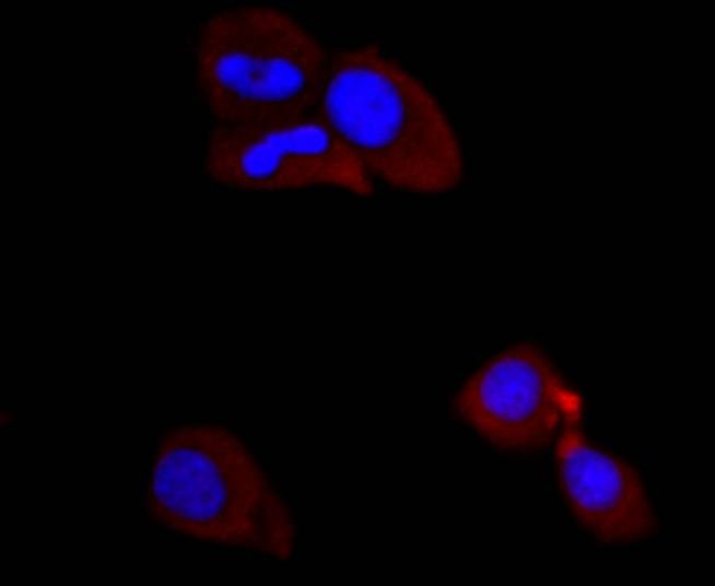 Anti-PIK3R1 Antibody (9O121)