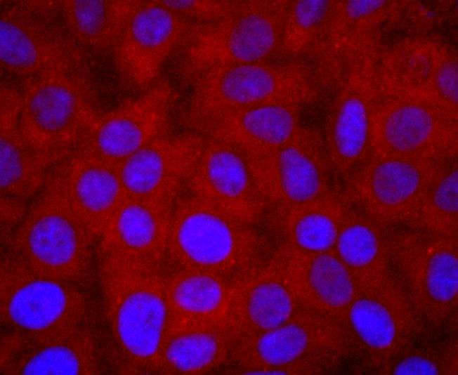 Anti-PIK3R1 Antibody (9O121)