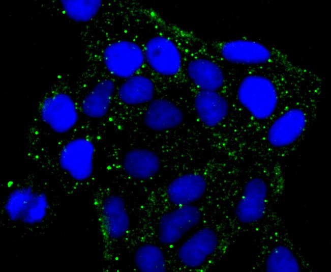 Anti-PKA 2 beta Antibody (8T490)