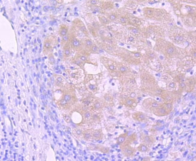 Anti-PIK3R1 Antibody (9O121)