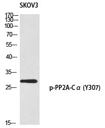 Anti-Phospho-PPP2CA (Tyr307) Polyclonal Antibody
