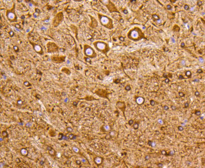 Anti-PI 3 Kinase p55 gamma Antibody (1C282)
