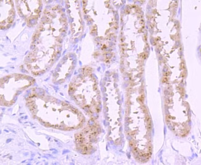 Anti-PIK3R1 Antibody (9O121)