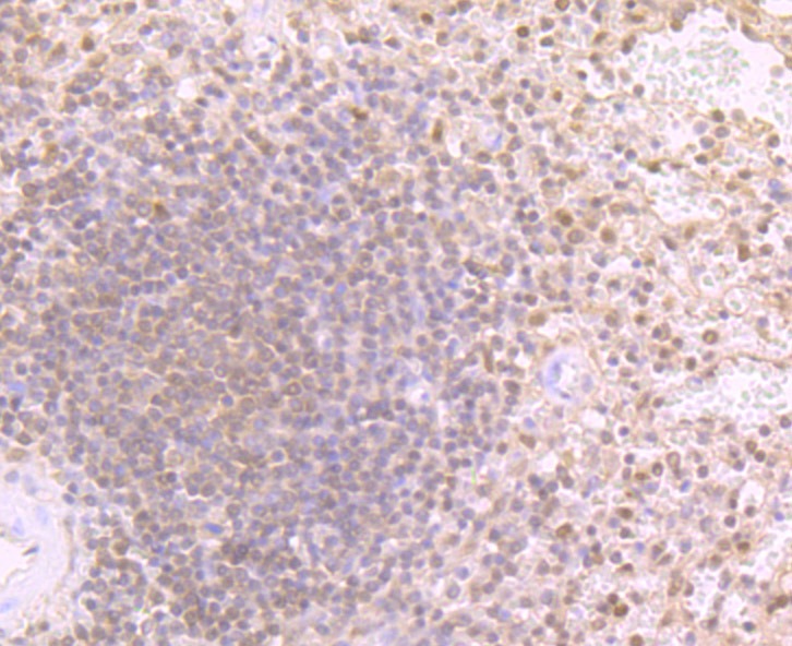 Anti-Proteasome 20S LMP2 Antibody (3S23)