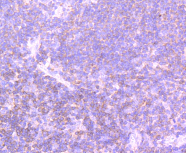 Anti-PI 3 Kinase p110 delta Antibody (6K824)