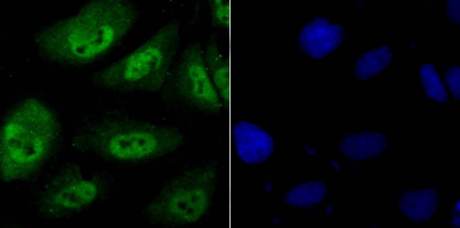Anti-PSMB8 Antibody (3I410)