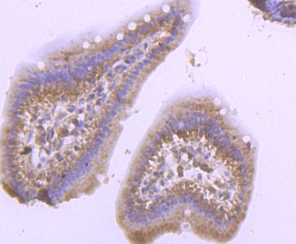 Anti-PSMB8 Antibody (3I410)