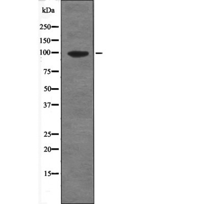 Anti-Phospho-Progesterone Receptor (Ser345) Polyclonal Antibody