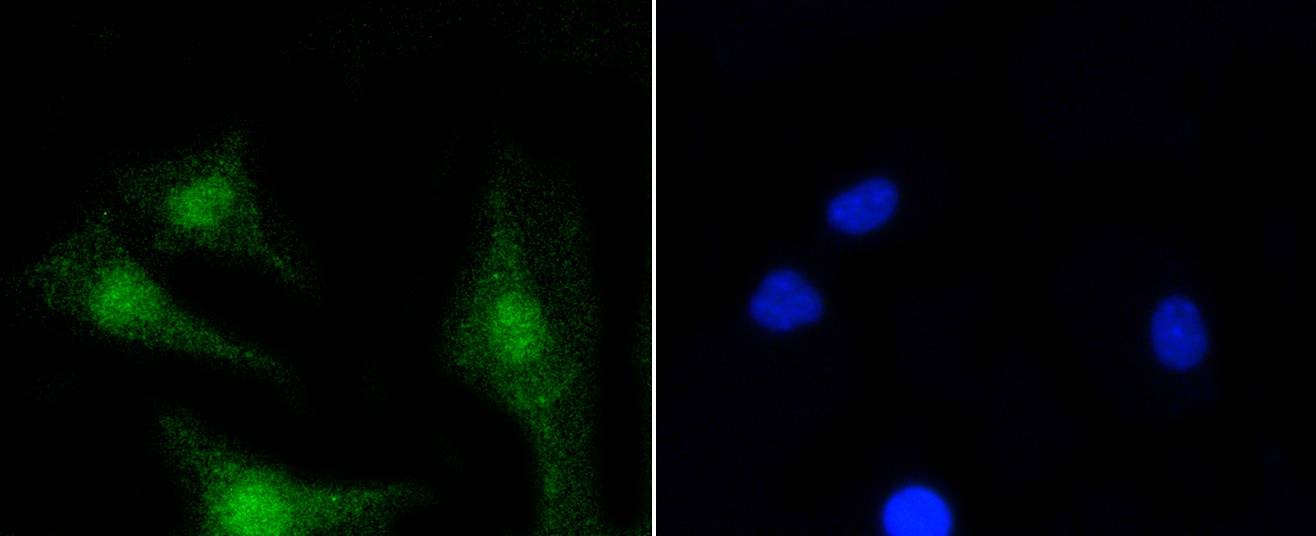 Anti-PKC beta Antibody (5T436)
