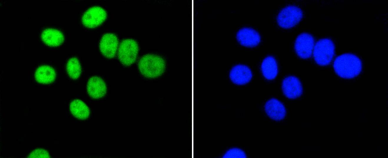 Anti-PIM1 Antibody (6F773)