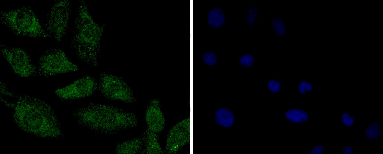 Anti-PP2A alpha/beta Antibody (6N831)