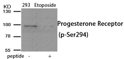 Anti-Phospho-Progesterone Receptor (Ser294) Polyclonal Antibody