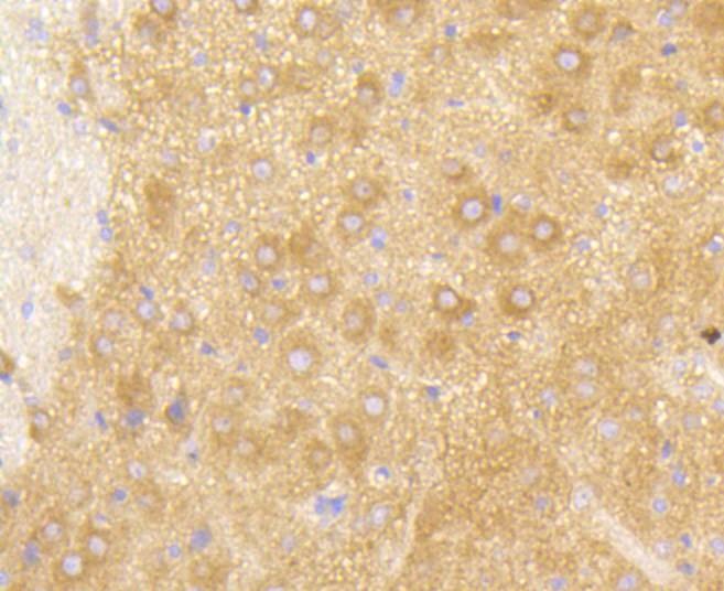 Anti-PI 3 Kinase p85 beta Antibody (9A867)