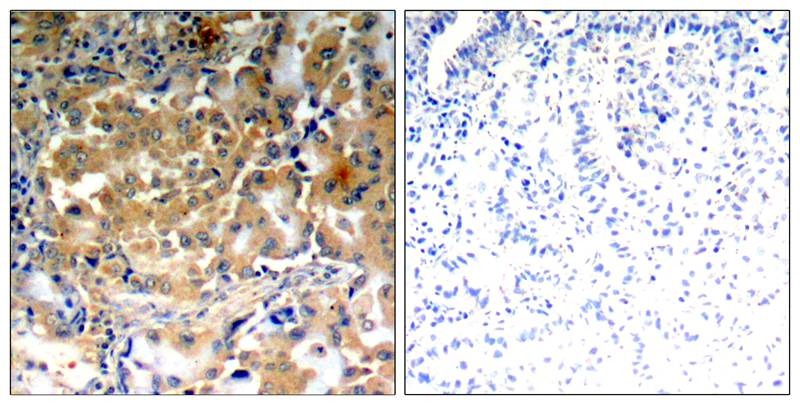 Anti-Phospho-PRKCZ (Thr410) Polyclonal Antibody