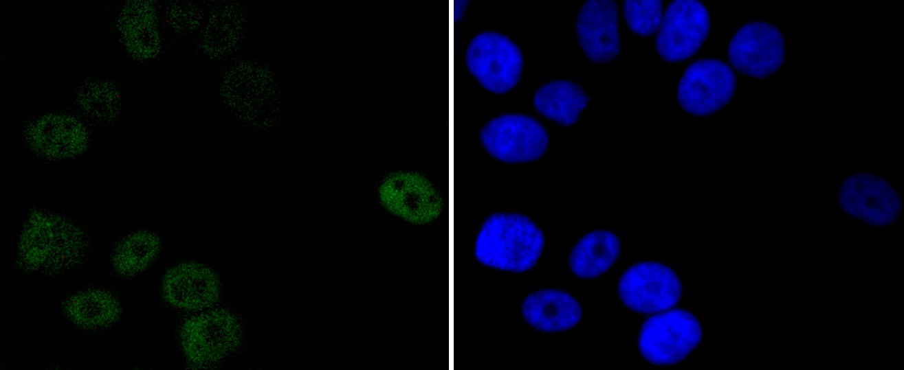Anti-Progesterone Receptor Antibody (9Z37)