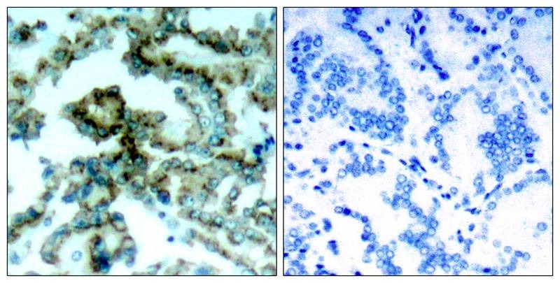 Anti-Phospho-PKC beta (Thr641) Polyclonal Antibody