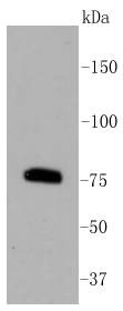 Anti-PKC beta Antibody (5T436)
