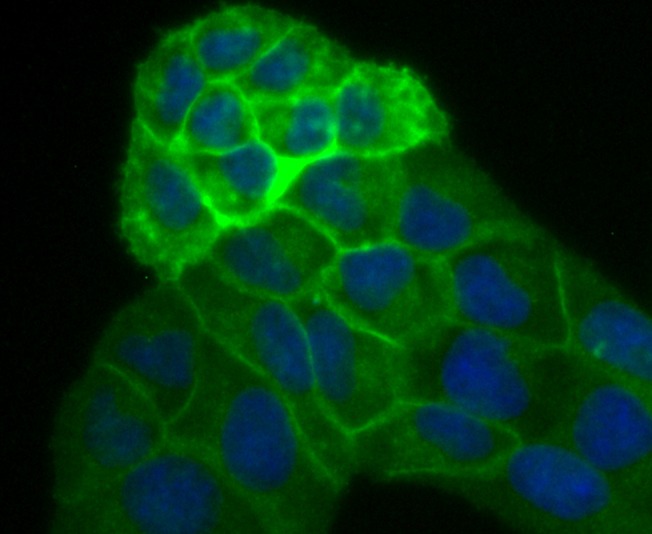 Anti-Alkaline Phosphatase (Placental type) /ALPP Antibody (8Z127)