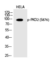 Anti-Phospho-PKD2 (Ser876) Polyclonal Antibody