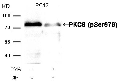 Anti-Phospho-PRKCQ (Ser676) Polyclonal Antibody
