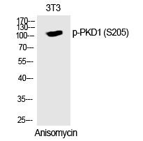 Anti-Phospho-PKD/PKCm (Ser205) Polyclonal Antibody
