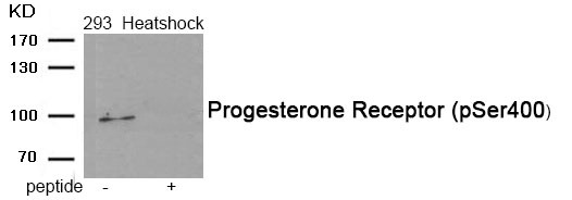 Anti-Phospho-Progesterone Receptor (Ser400) Polyclonal Antibody