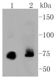 Anti-PRKCA Antibody (6S104)