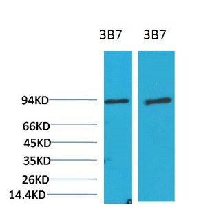Anti-PIK3R1 Antibody (5U86)