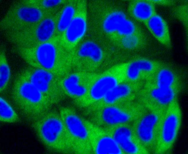 Anti-PI 3 Kinase p85 beta Antibody (9A867)