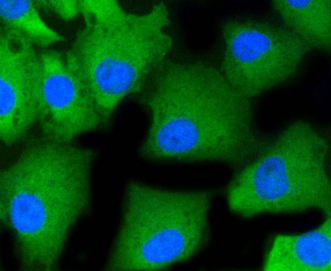 Anti-PRKCA Antibody (6S104)