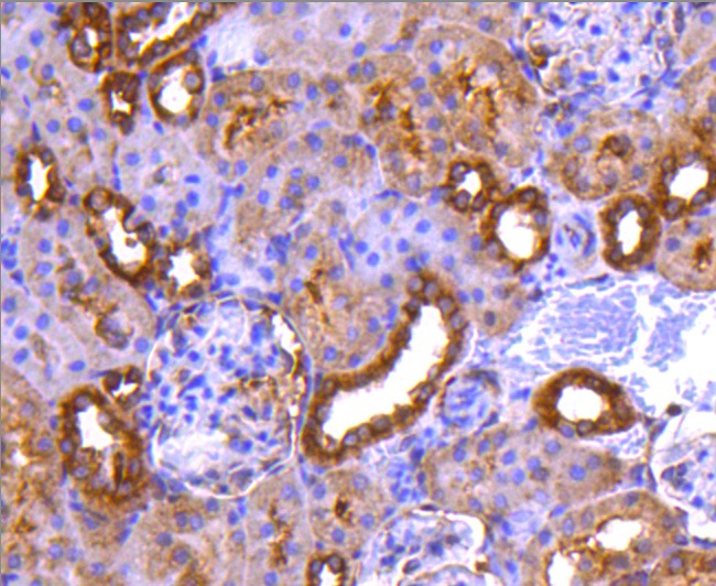 Anti-PP2A alpha/beta Antibody (6N831)