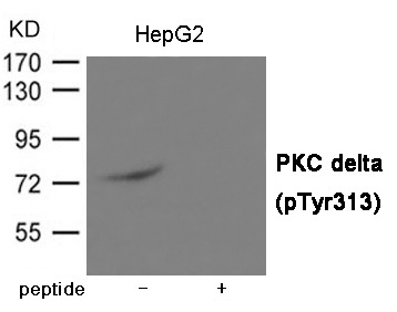 Anti-Phospho-PRKCD (Tyr313) Polyclonal Antibody