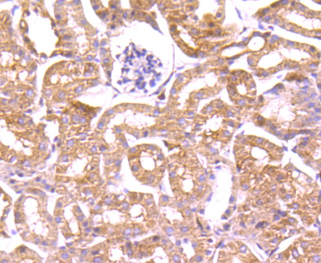 Anti-Profilin-1 Antibody (1I976)