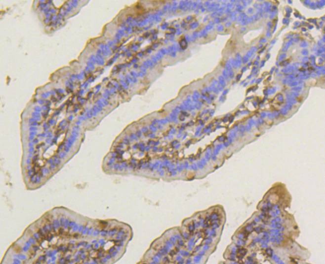 Anti-PRKCA Antibody (6S104)
