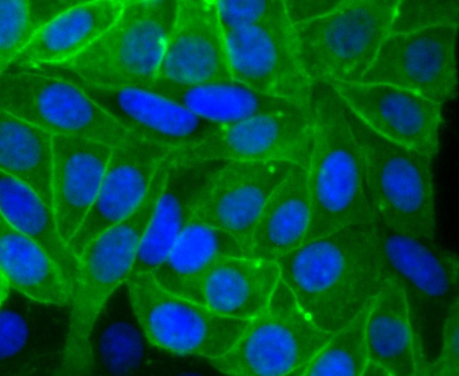 Anti-Alkaline Phosphatase (Placental type) /ALPP Antibody (8Z127)