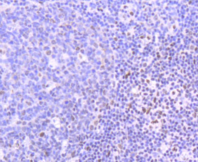 Anti-PIM1 Antibody (6F773)