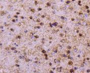 Anti-PPP1R1A Antibody (4O879)