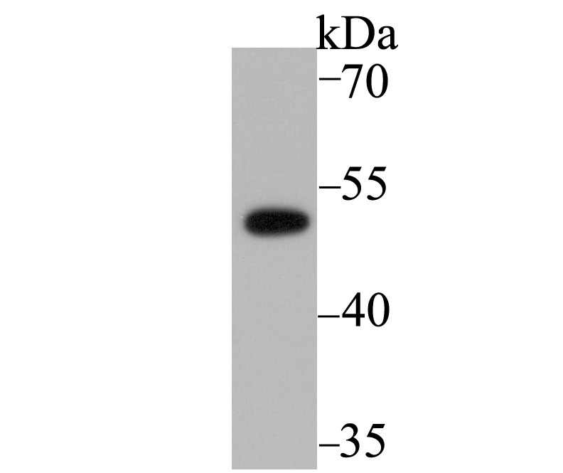 Anti-PICK1 Antibody (5X729)