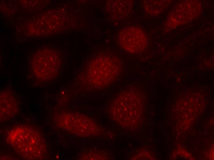 Anti-Phospho-PKC beta (Thr641) Polyclonal Antibody