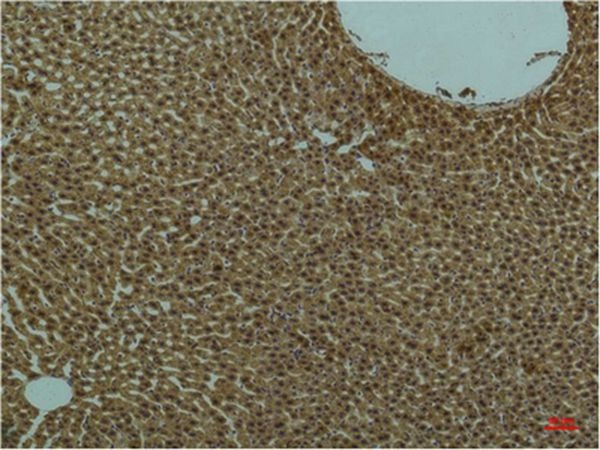 Anti-PIK3R1 Antibody (5U86)