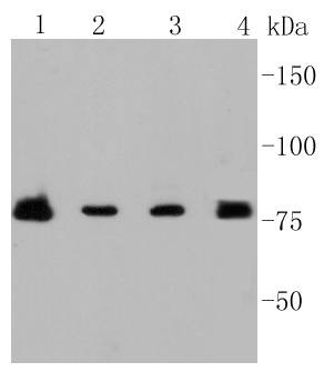 Anti-PI 3 Kinase p85 beta Antibody (9A867)